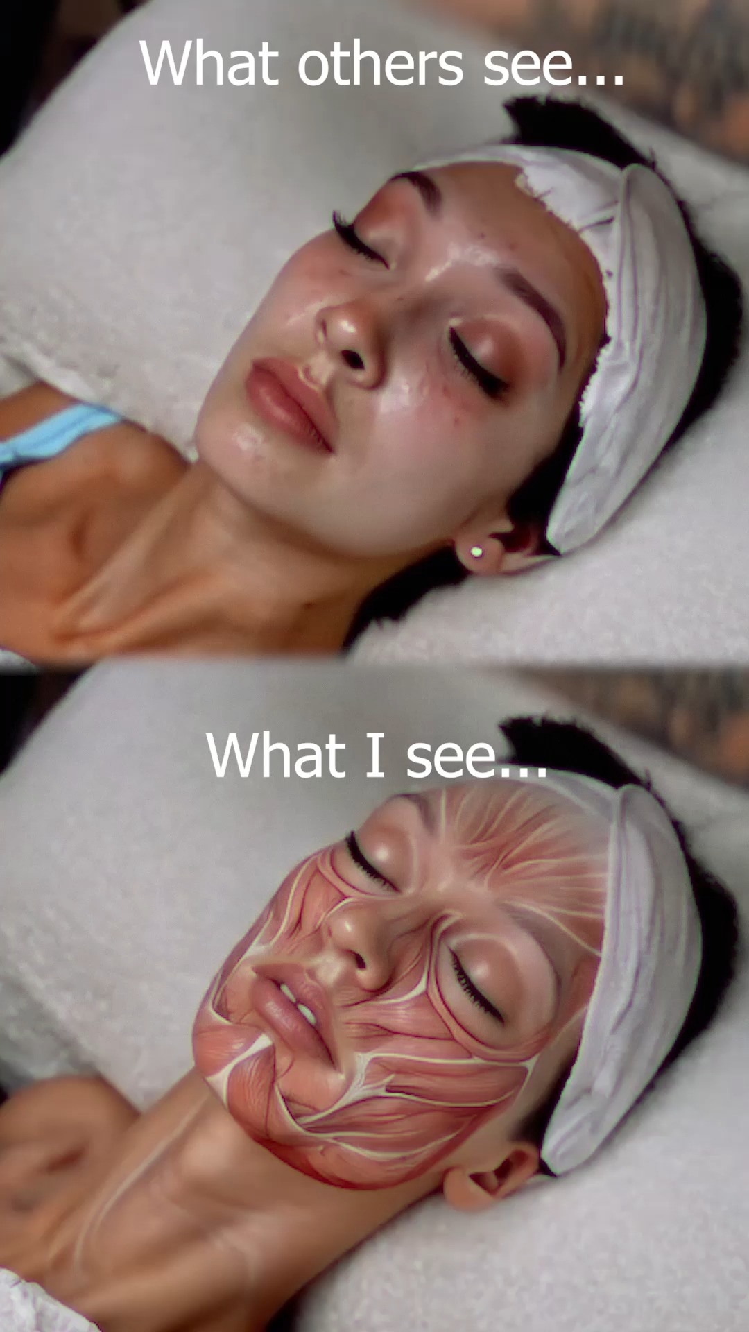 What I see? What other people see?
#drkisiel #medycynaestetyczna #aestheticmedicine #eskulap #londyn