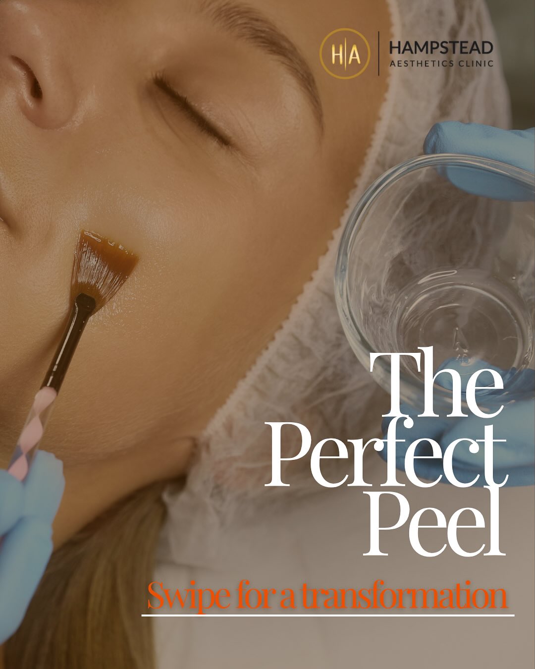 ✨ Reveal glowing, baby-soft skin with The Perfect Peel ✨
This powerful one-step treatment targets pigmentation, acne, f