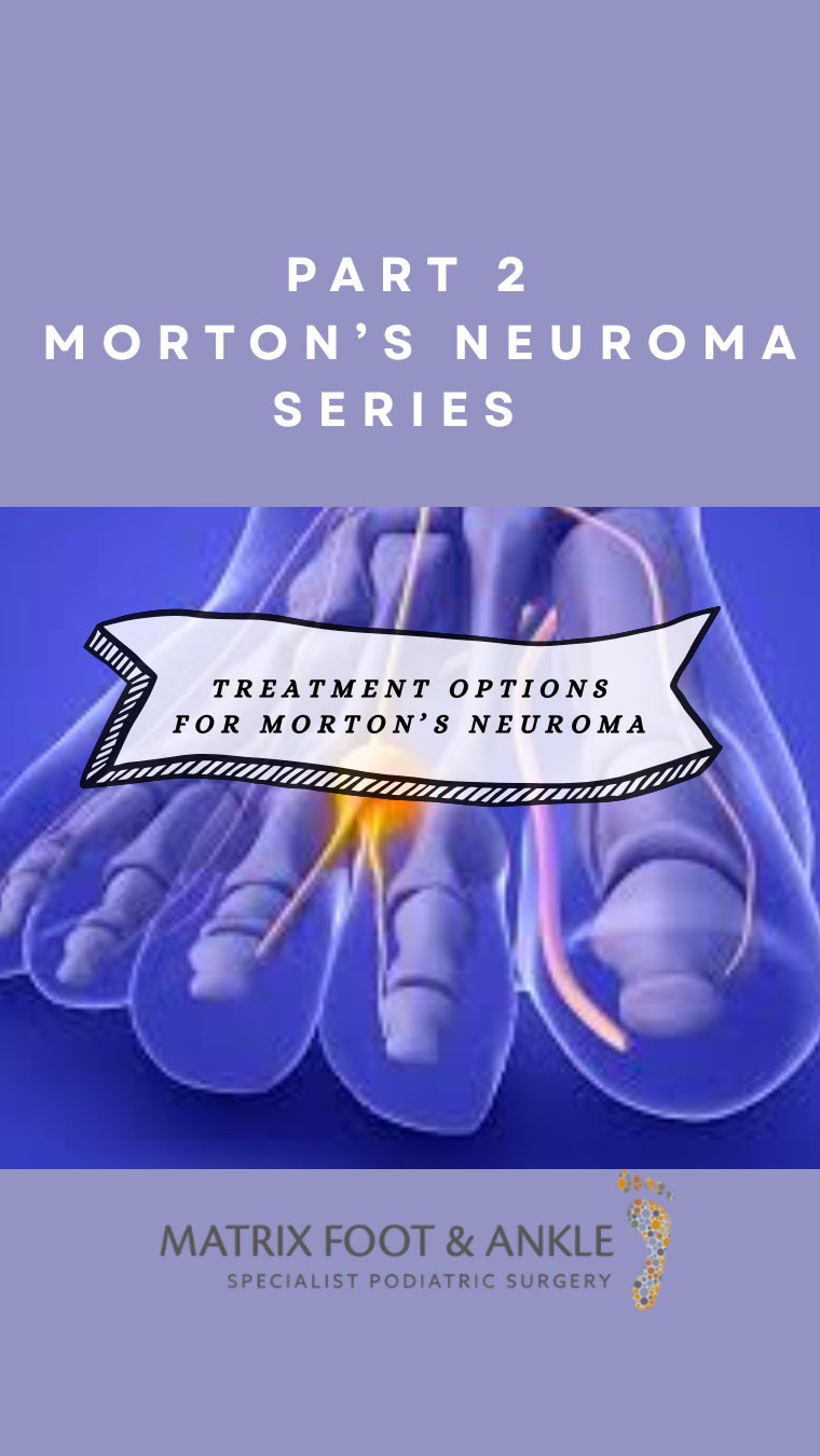 This video discusses treatment options for Morton’s Neuroma. To find out more, please go to our bio and follow the link