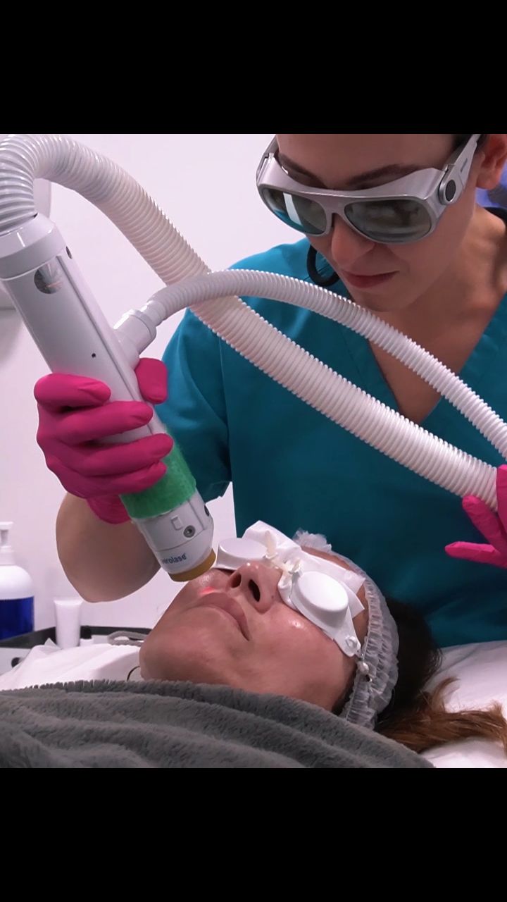 Aerolase, performed by our specialist laser technician Betul, is a powerful yet gentle treatment that does it all. This