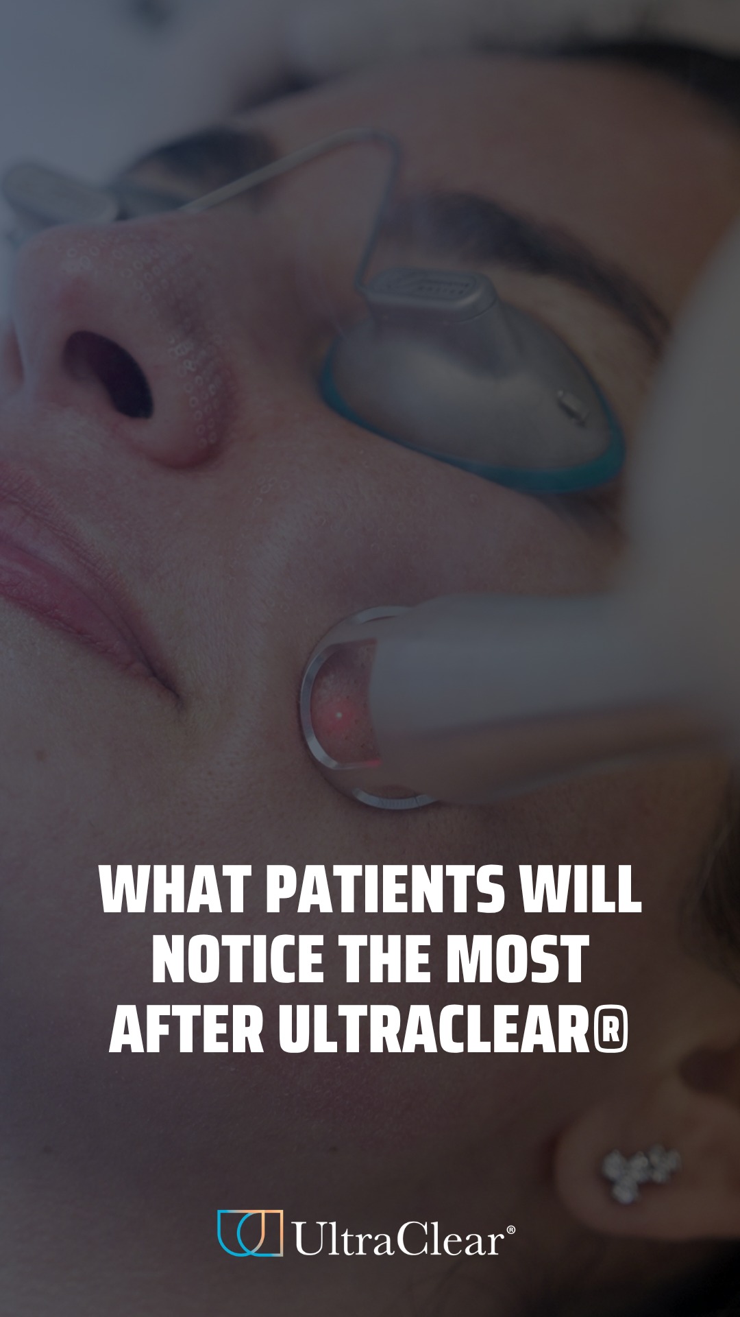 What patients will notice the most post UltraClear® laser.
Award-winning @remedilondon @dr.nima are delivering results