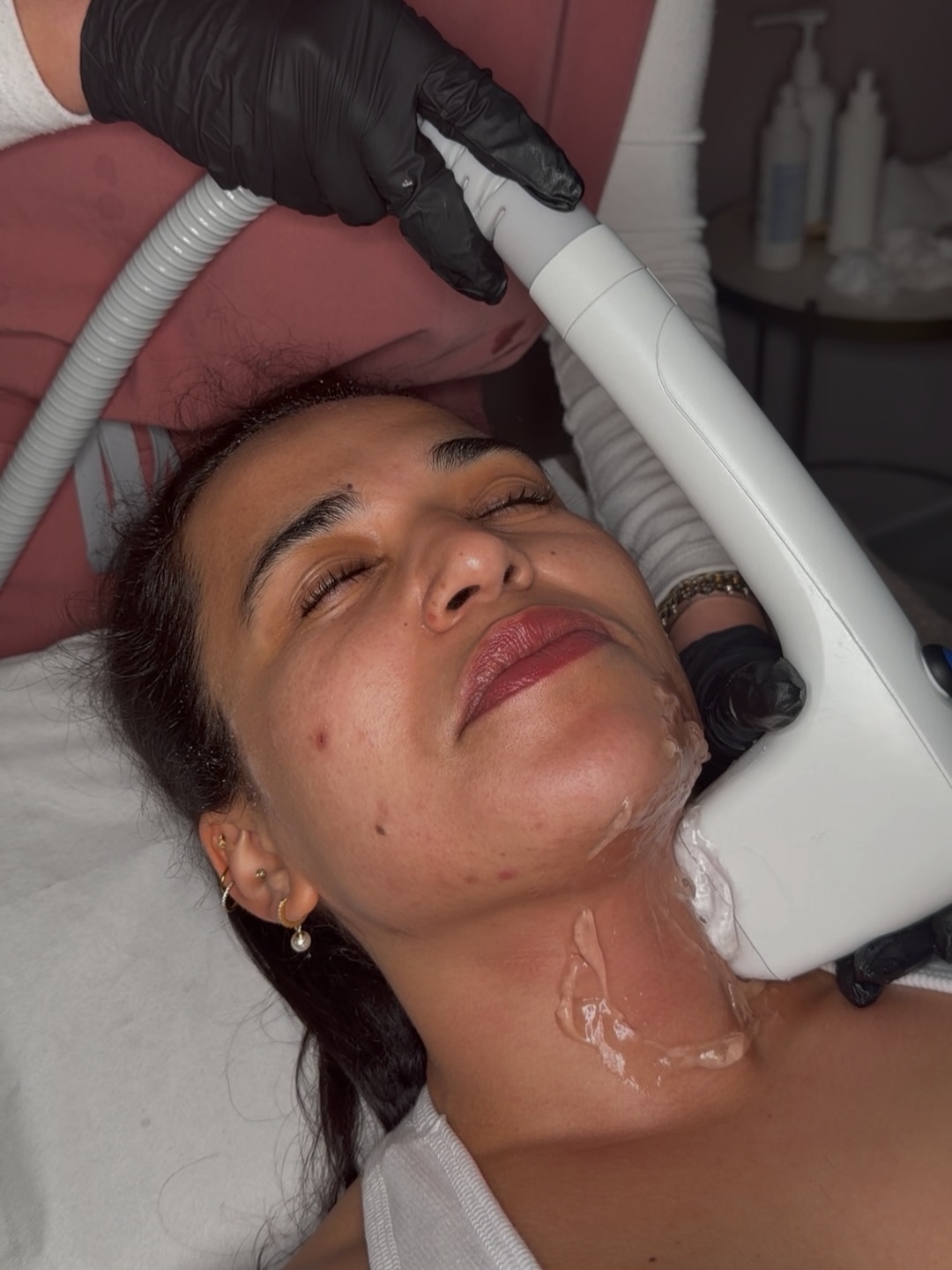 Your most asked questions about Sofwave, answered.
"Does Sofwave actually work?"
Yes. Sofwave uses advanced ultrasound